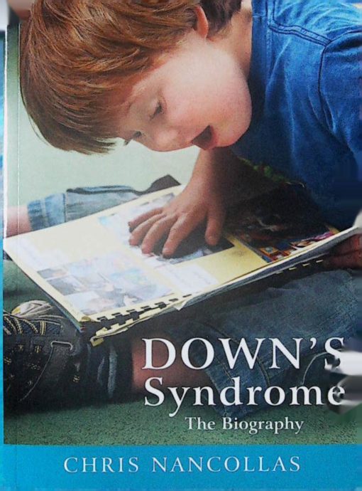 DOWN'S SYNDROME THE BIOGRAPHY